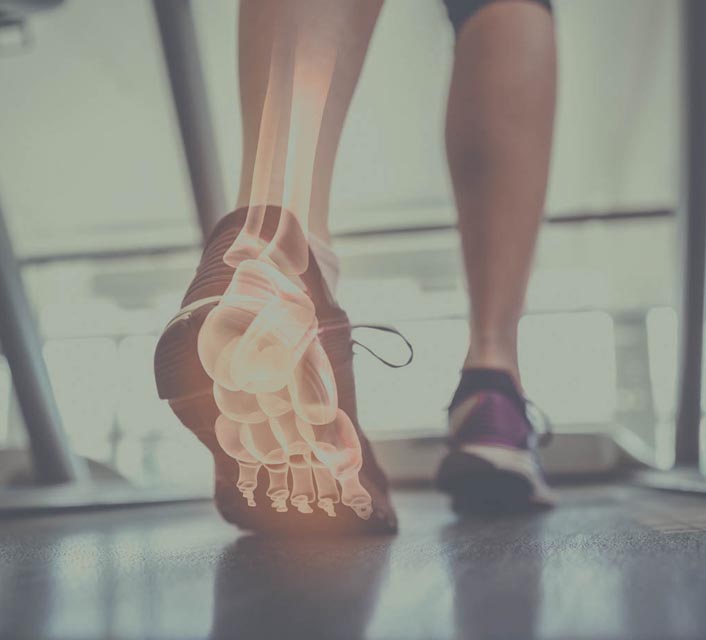 Gang en bewegingsanalyse