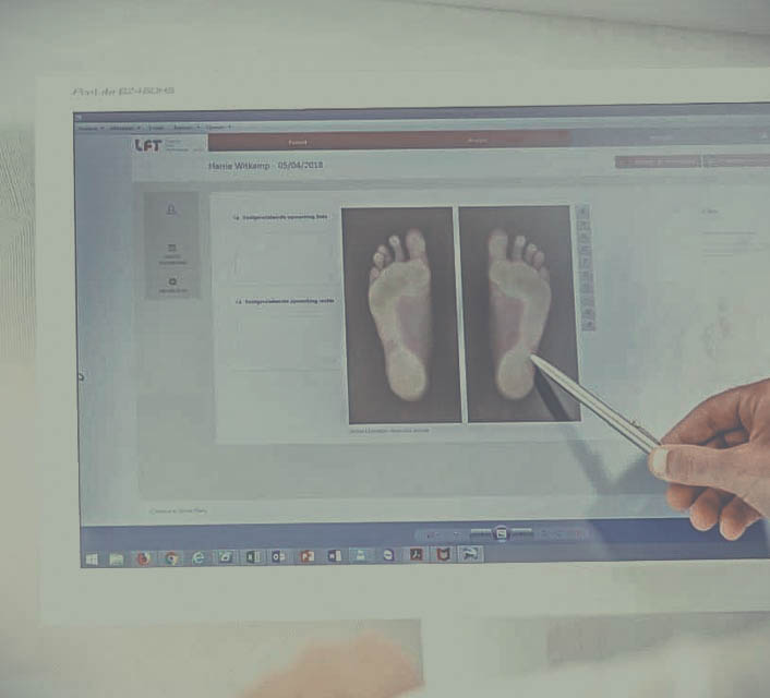 Statische afdruk van de voet middels een voetscan of blauwdrukraam
